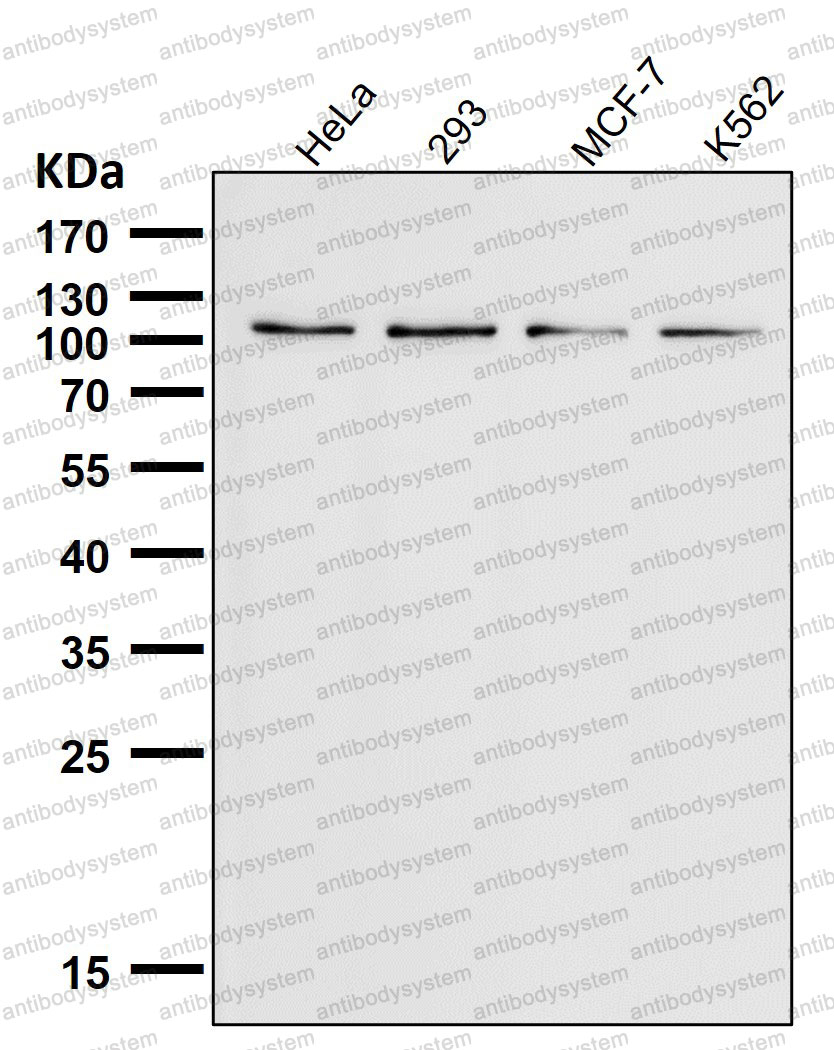 Anti-TRPM8 Antibody (R2L64)