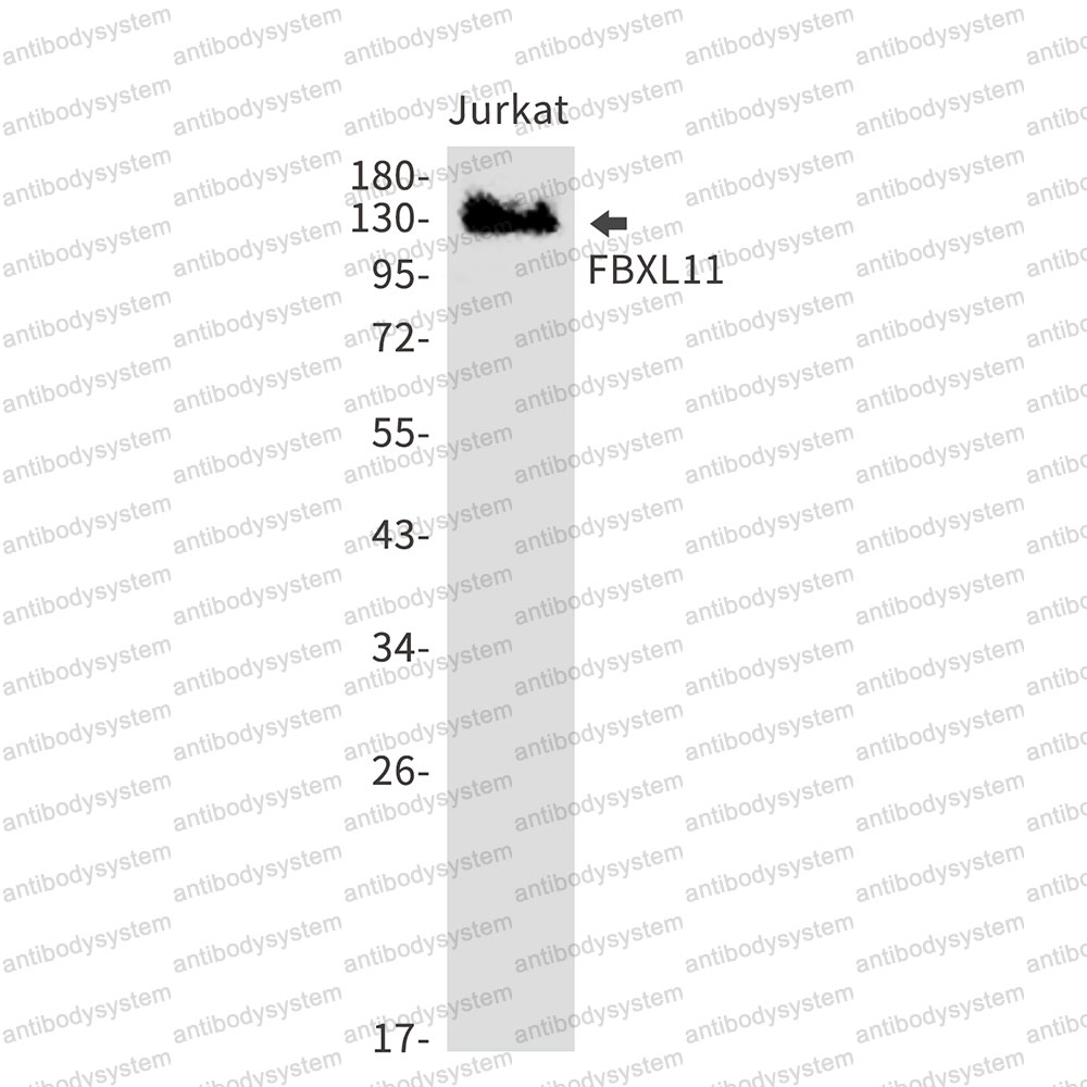 Anti-KDM2A Antibody (R2L66)