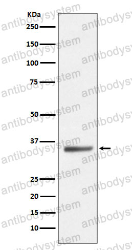 Anti-SIRT5 Antibody (R2L70)
