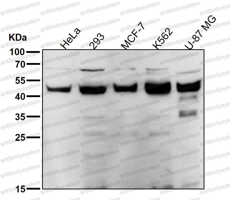 Anti-SMYD3 Antibody (R2L71)