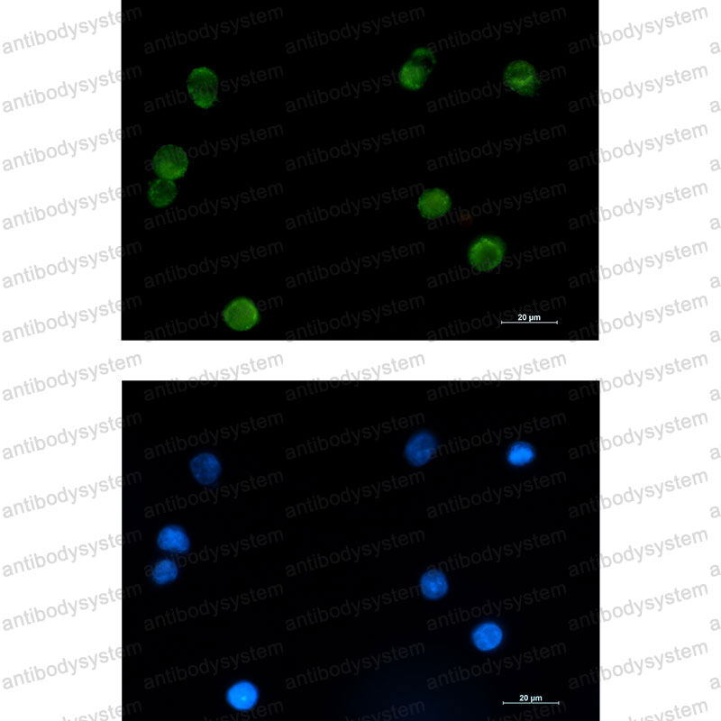 Anti-SMYD3 Antibody (R2L72)