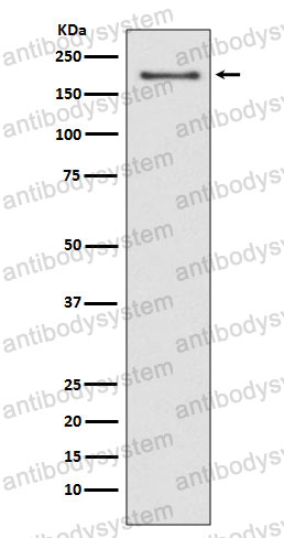 Anti-NSD3/WHSC1L1 Antibody (R2L73)