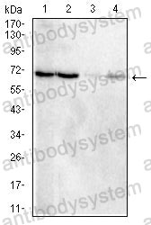 Western blot for Anti-TIMD4/TIM-4 Antibody (R3Y63) ?>