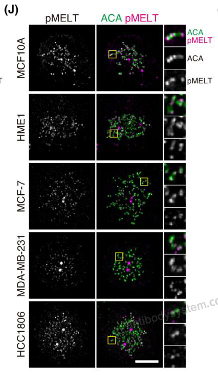 Immunofluorescence for Anti-Phospho-CASC5 (pT943) Antibody (pMELT-KNL1) ?>