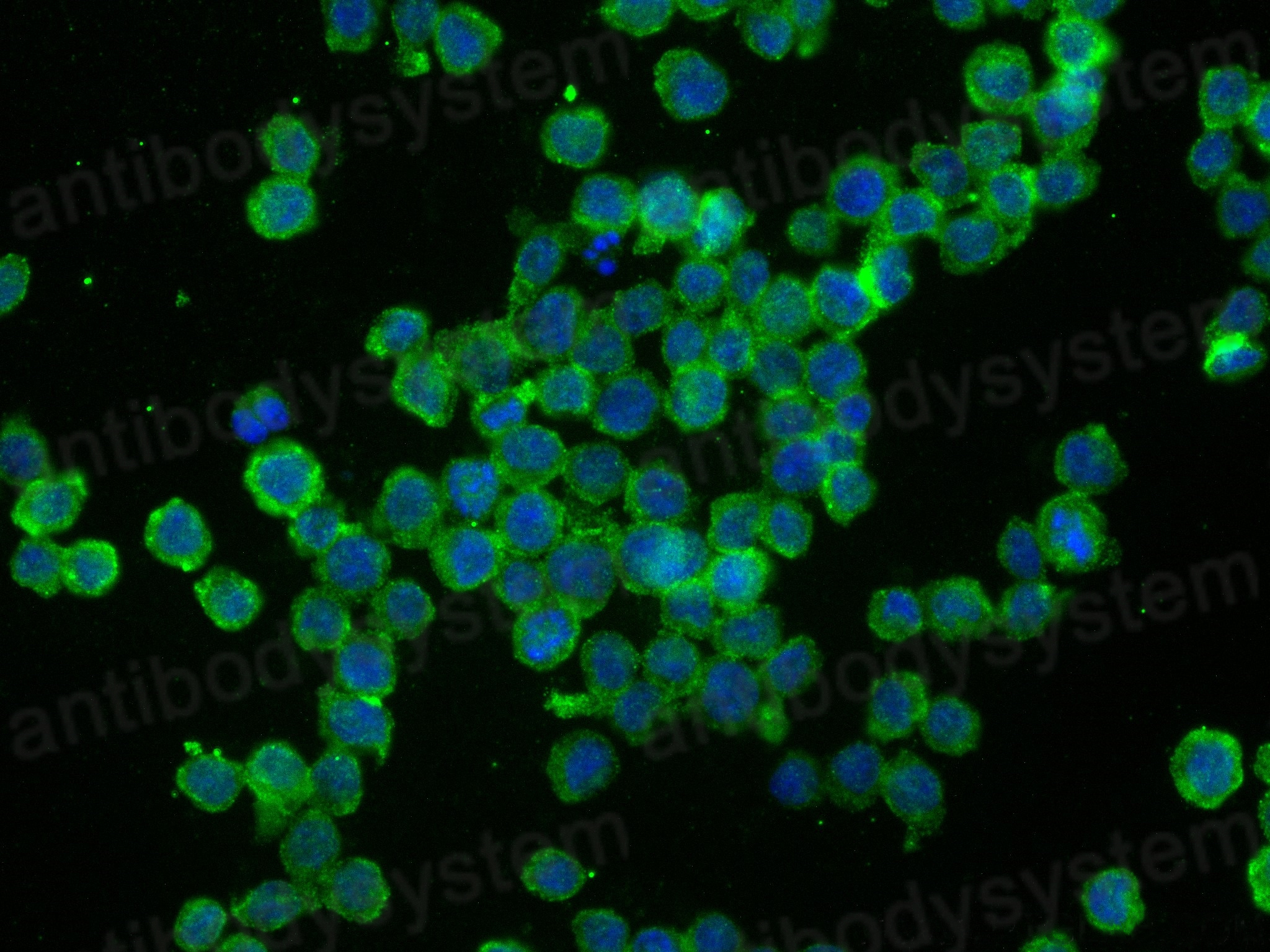 Anti-PIEZO1 Antibody (R4E04)