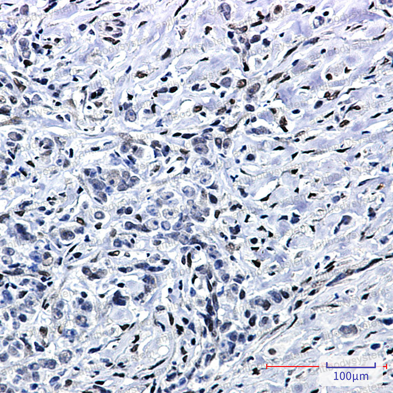 Anti-FTO Antibody (R2L77)