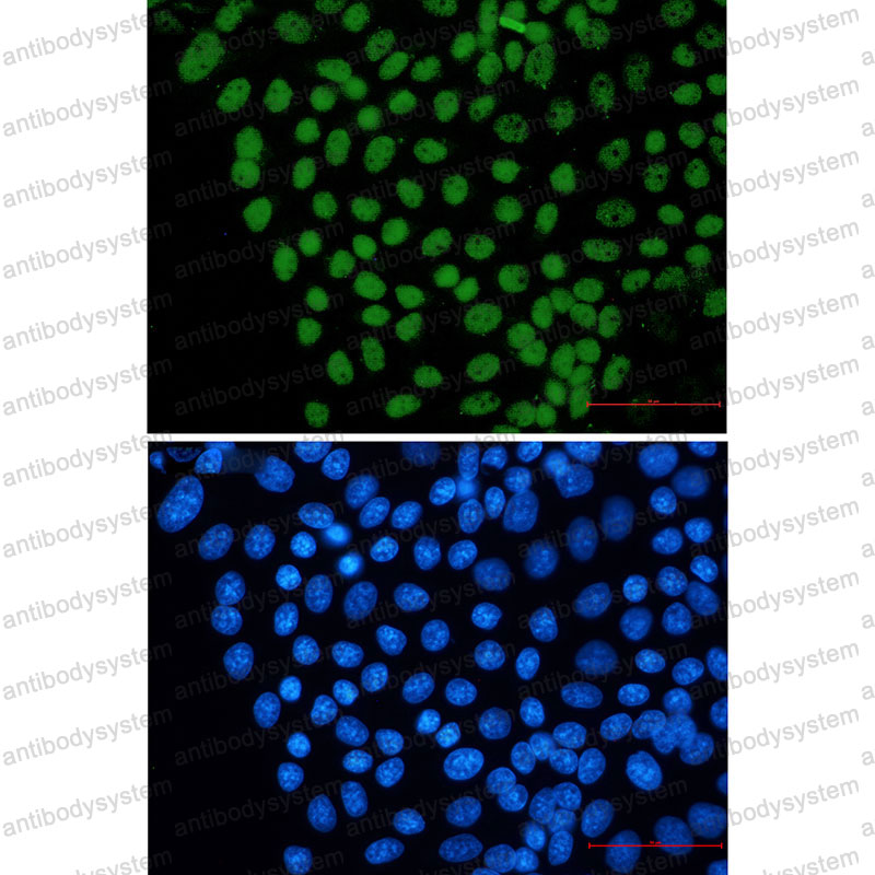 Anti-FTO Antibody (R2L76)