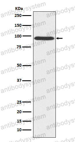 Anti-GPHN/Gephyrin Antibody (R2L78)