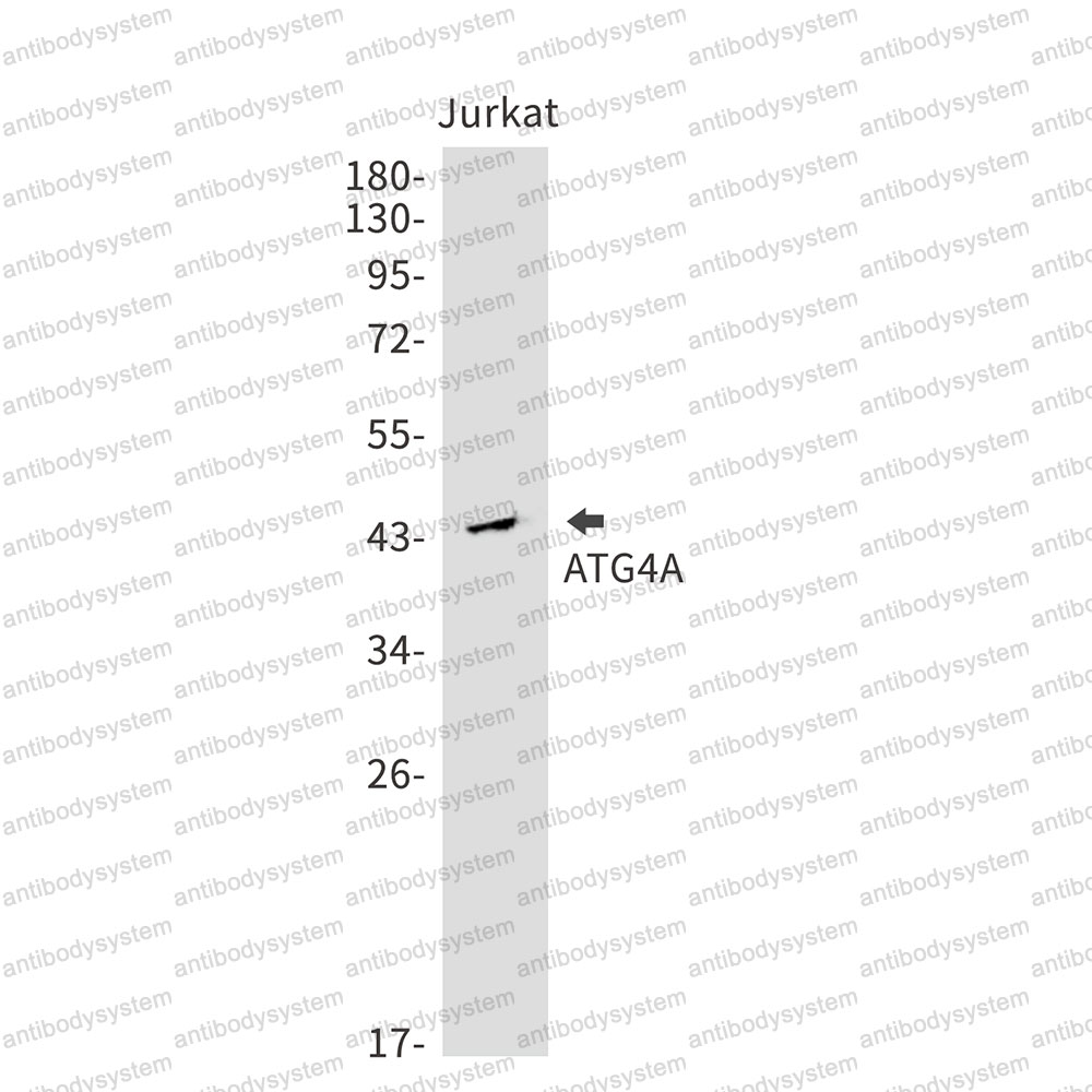Anti-ATG4A Antibody (R2L79)