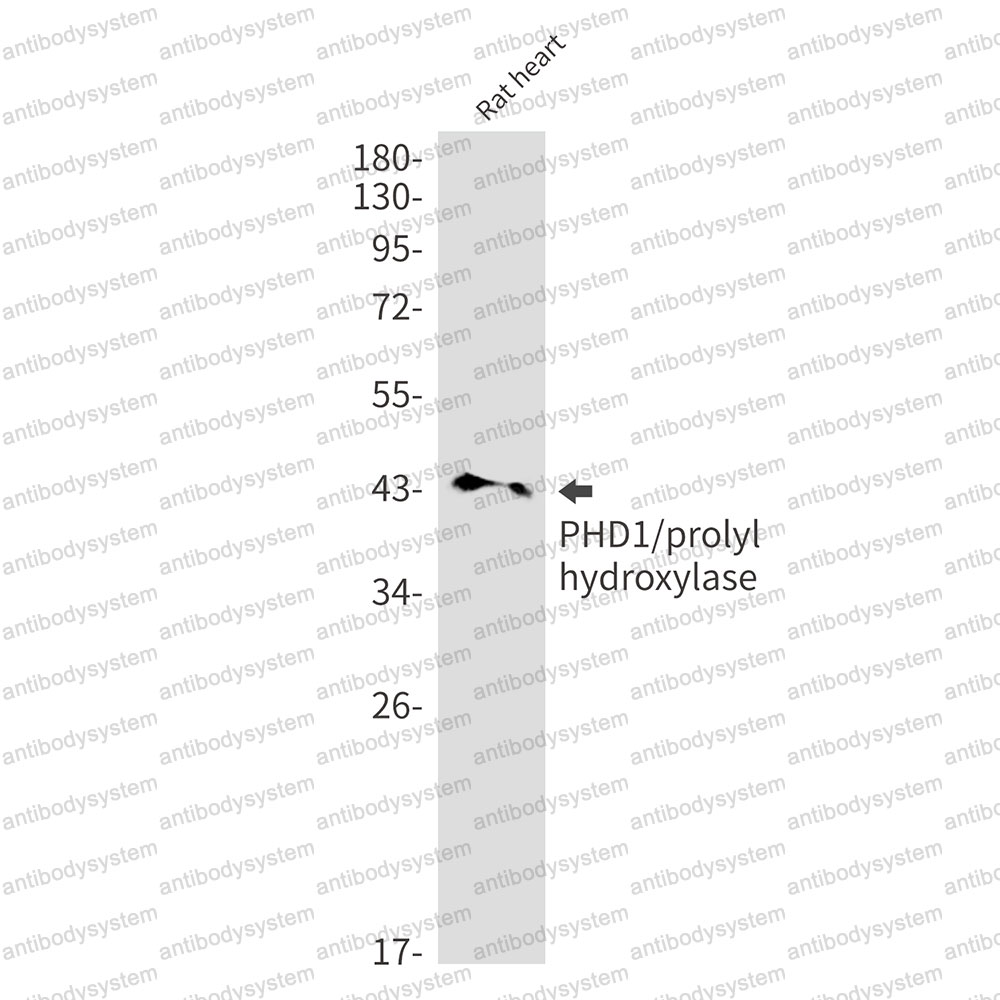 Anti-EGLN2/EIT6 Antibody (R2L80)