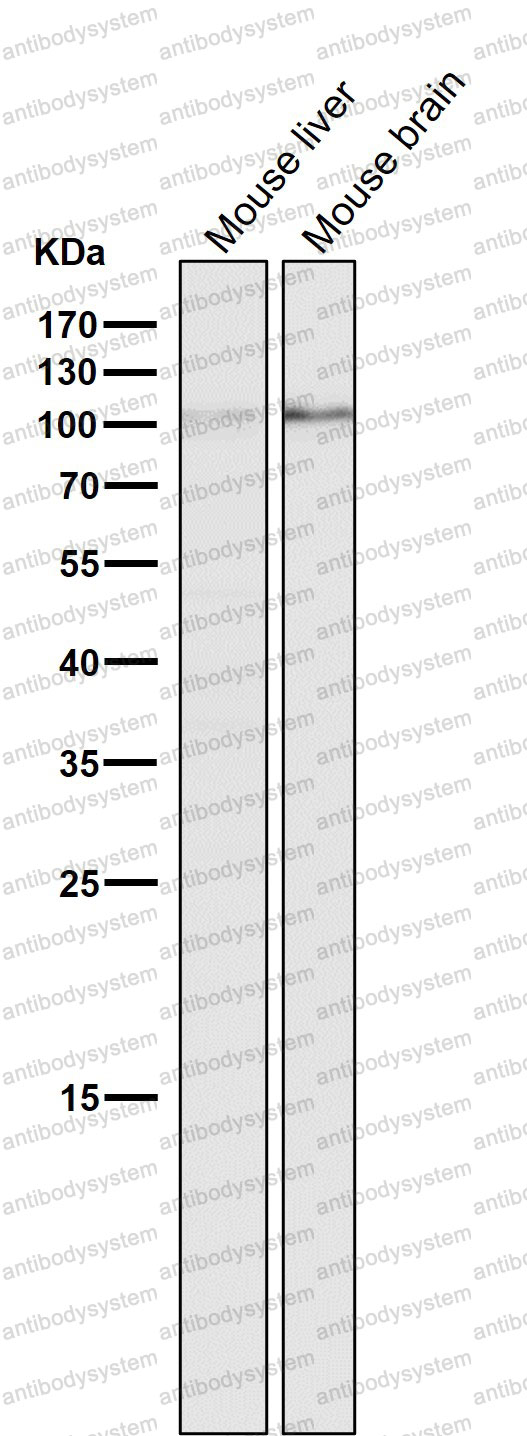 Anti-DGCR8 Antibody (R1C38)