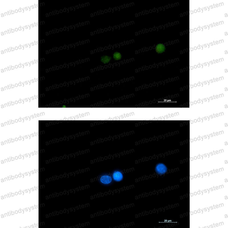Anti-DGCR8 Antibody (R2L81)