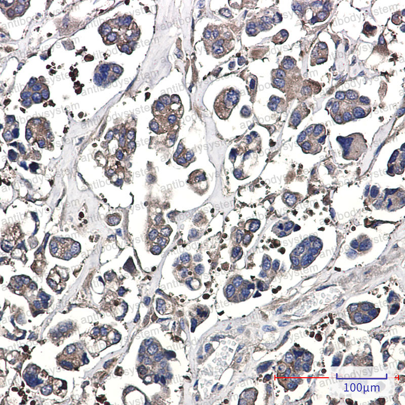 Anti-OPTN Antibody (R2L82)