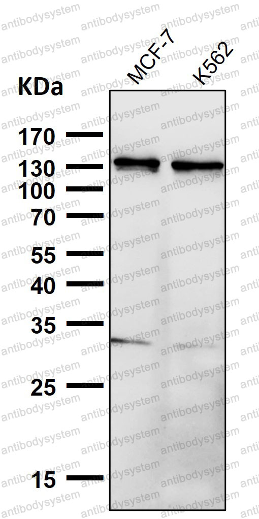 Anti-PALLD Antibody (R2L83)