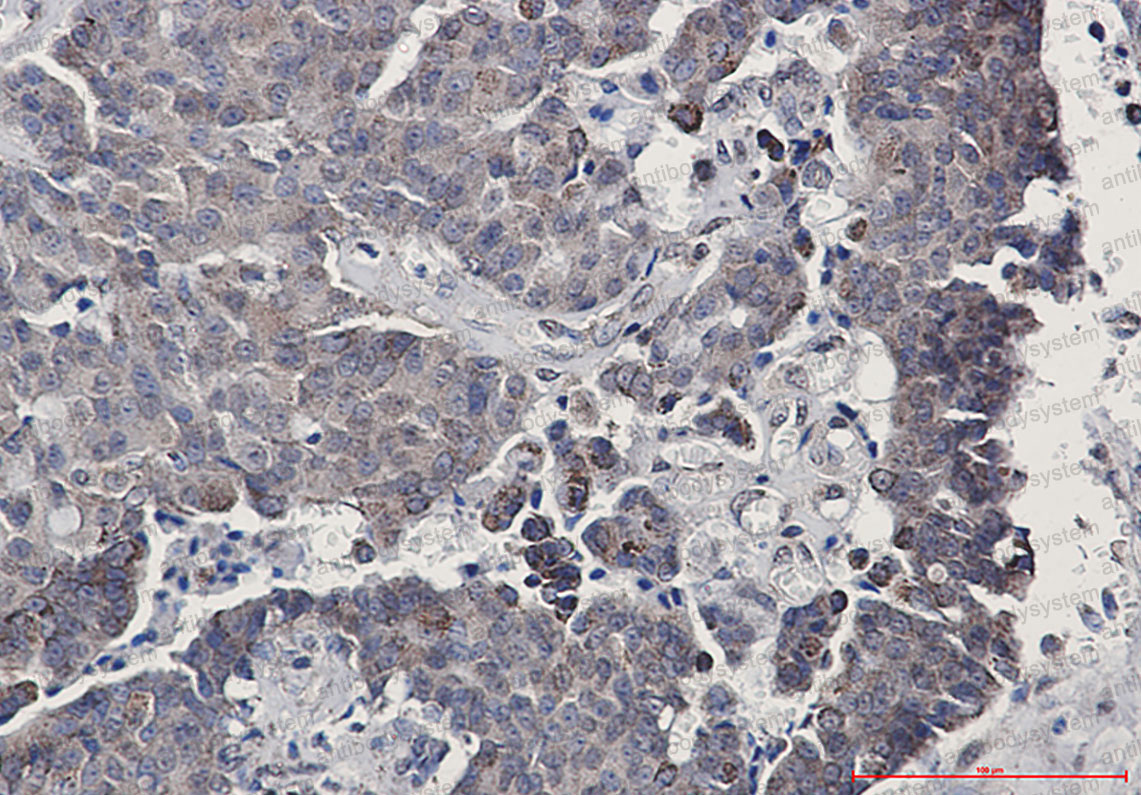 Anti-SIRT3 Antibody (R2L85)