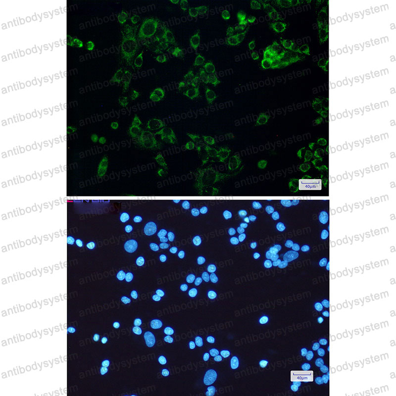 Anti-STOML2 Antibody (R2L88)