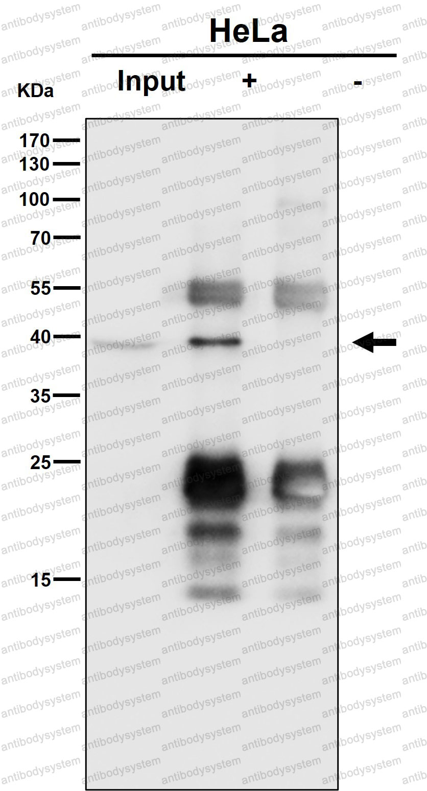 Anti-STOML2 Antibody (R2L87)
