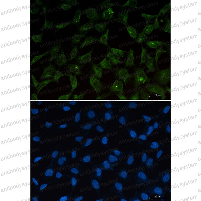 Anti-BBC3 Antibody (R2L89)