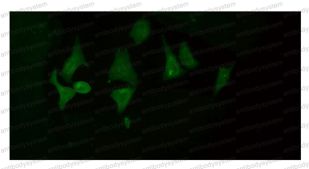 Anti-PGC1 alpha/beta Antibody (R2L90)