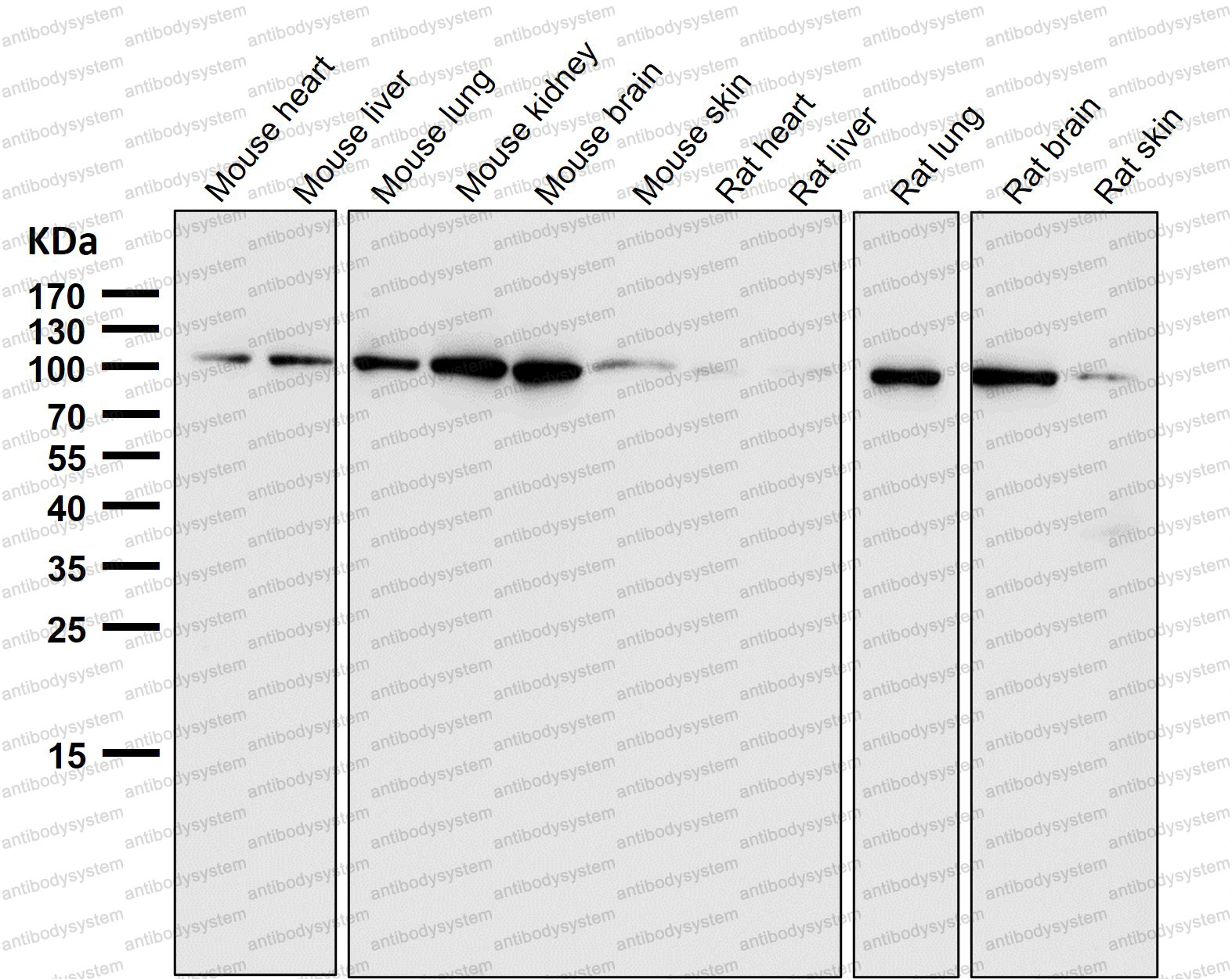 Anti-EXOC2 Antibody (R2L91)