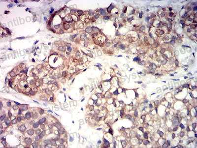 Immunohistochemical for Anti-KMT5A Antibody (R3Y85) ?>