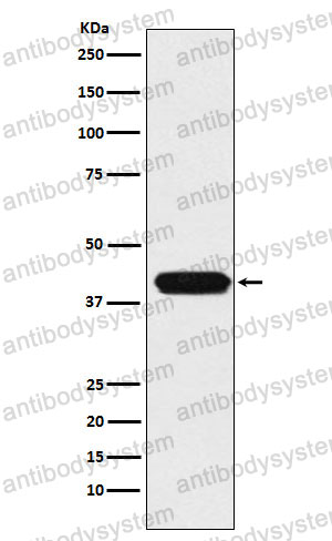 Anti-ATOH1 Antibody (R2L92)