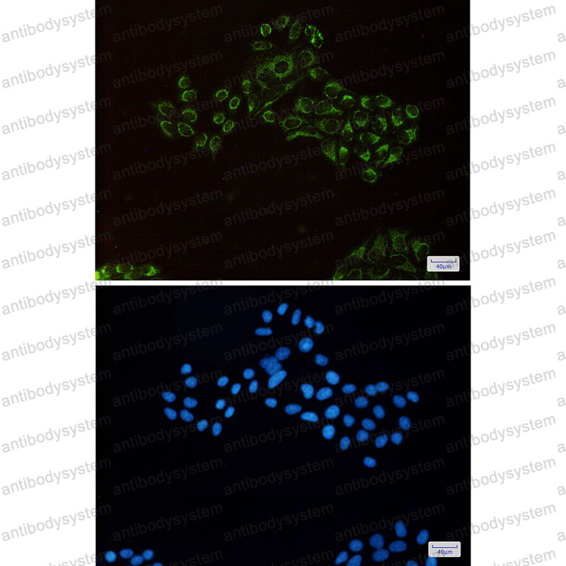 Anti-PHB2 Antibody (R2L94)