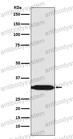 Anti-PHB2 Antibody (R2L93)