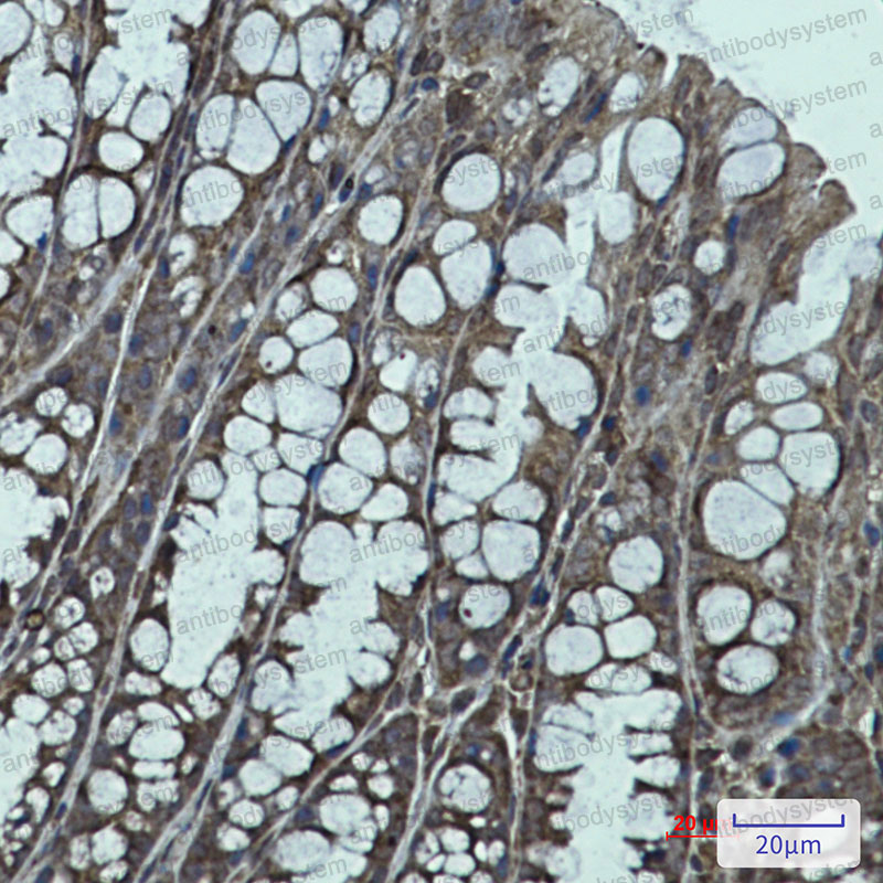 Anti-IGF2BP1 Antibody (R2L95)