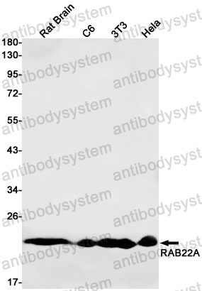 Anti-RAB22A Antibody (R2L97)