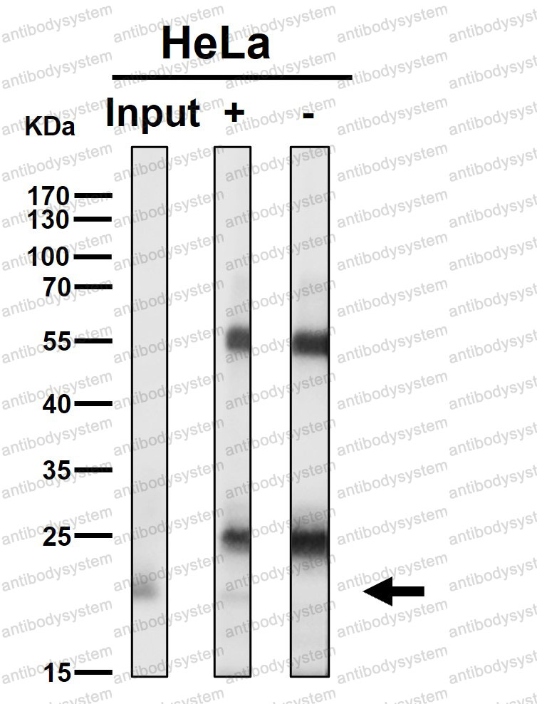Anti-RAB22A Antibody (R2L96)