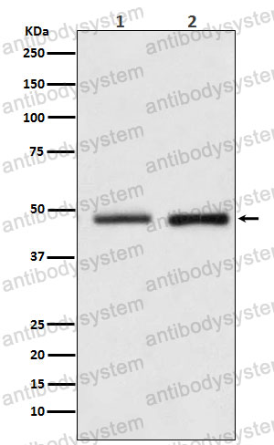Anti-RUVBL2 Antibody (R2L98)
