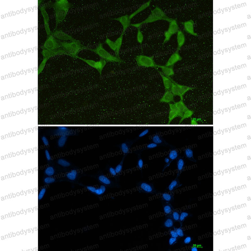 Anti-DDX21 Antibody (R2L99)