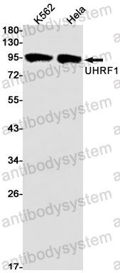 Anti-UHRF1 Antibody (R2M01)