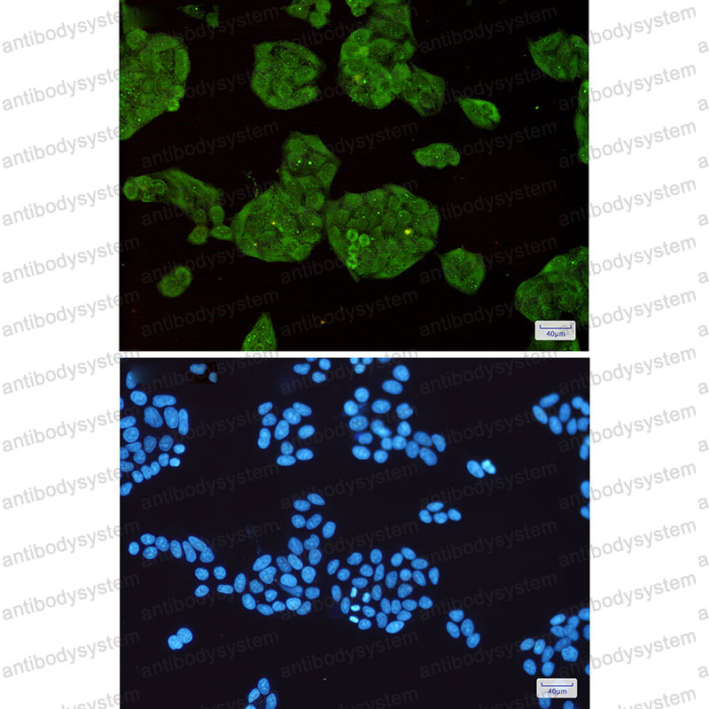 Anti-STUB1 Antibody (R2M03)