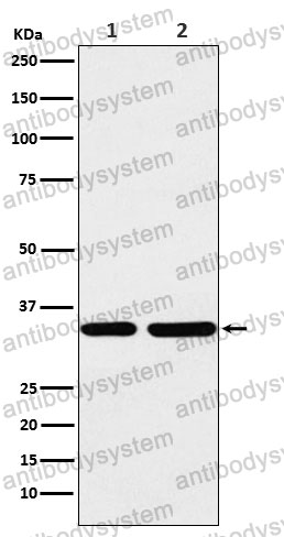 Anti-STUB1 Antibody (R2M02)