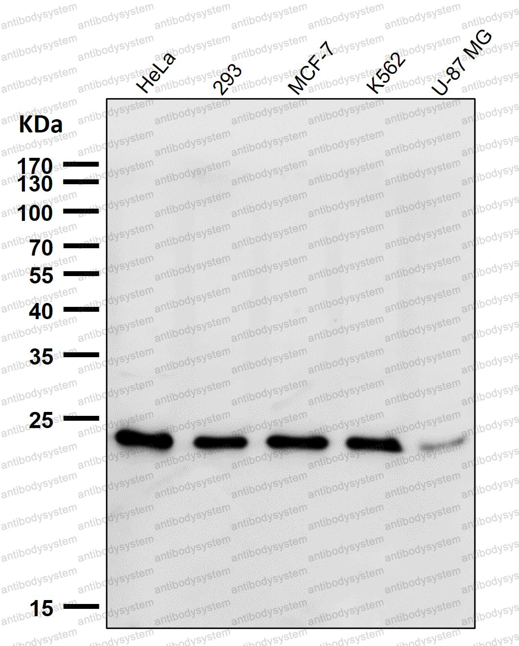 Anti-UBE2T Antibody (R2M04)
