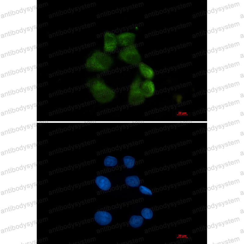 Anti-USP13 Antibody (R2M06)
