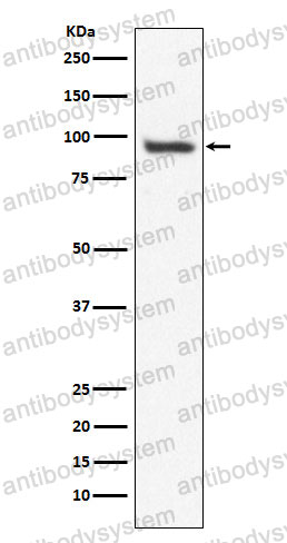 Anti-USP13 Antibody (R2M05)
