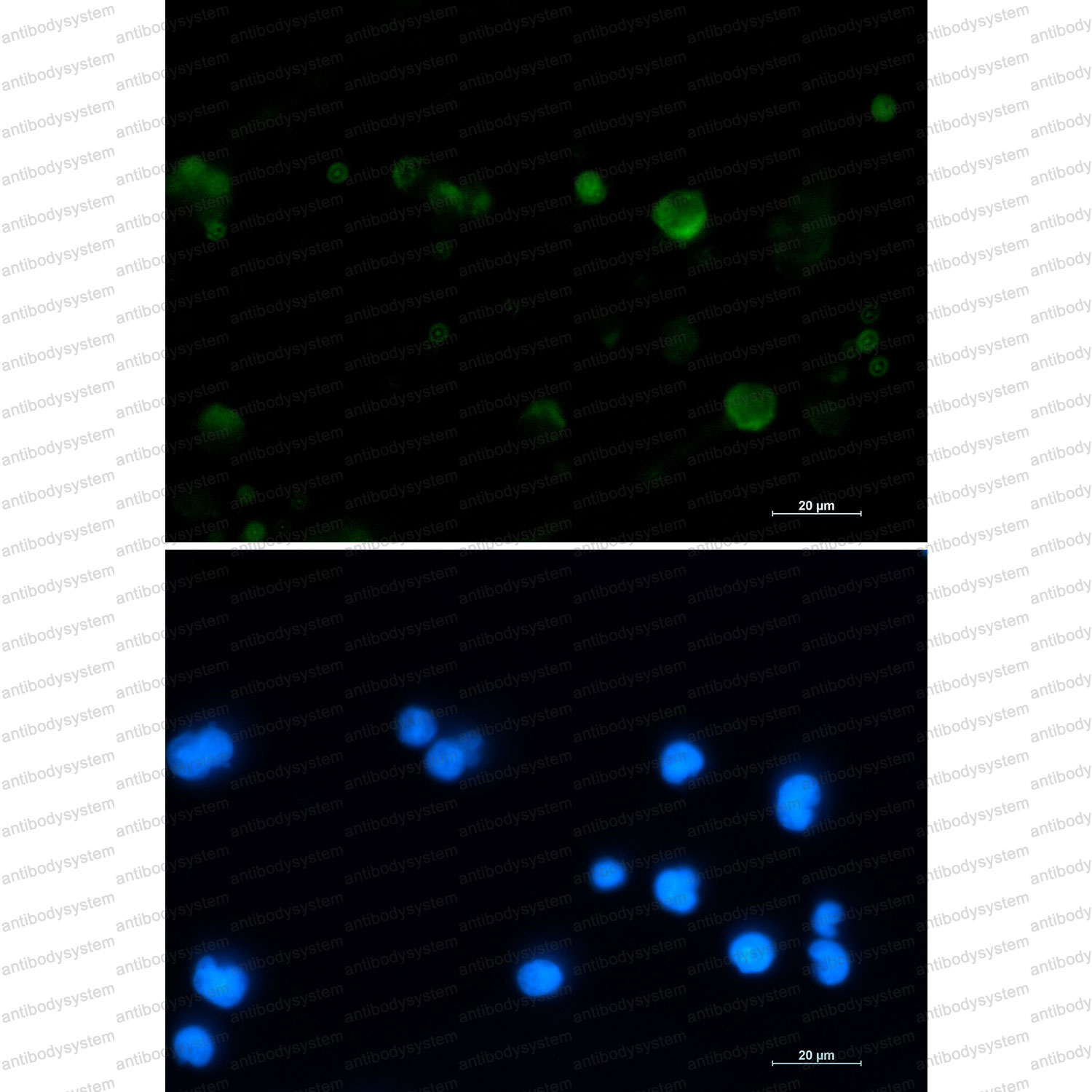 Anti-ACO2 Antibody (R2M08)