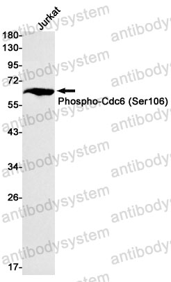 Anti-Phospho-CDC6 (Ser106) Antibody (R2M11)