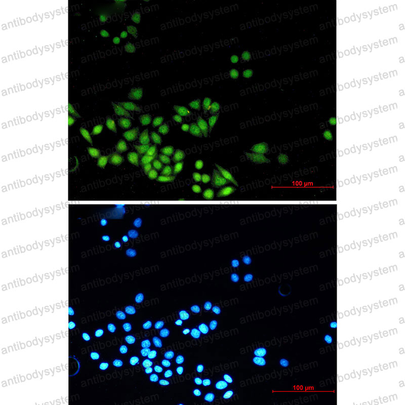 Anti-MAD2L2 Antibody (R2M14)