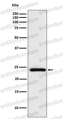 Anti-MAD2L2 Antibody (R2M13)