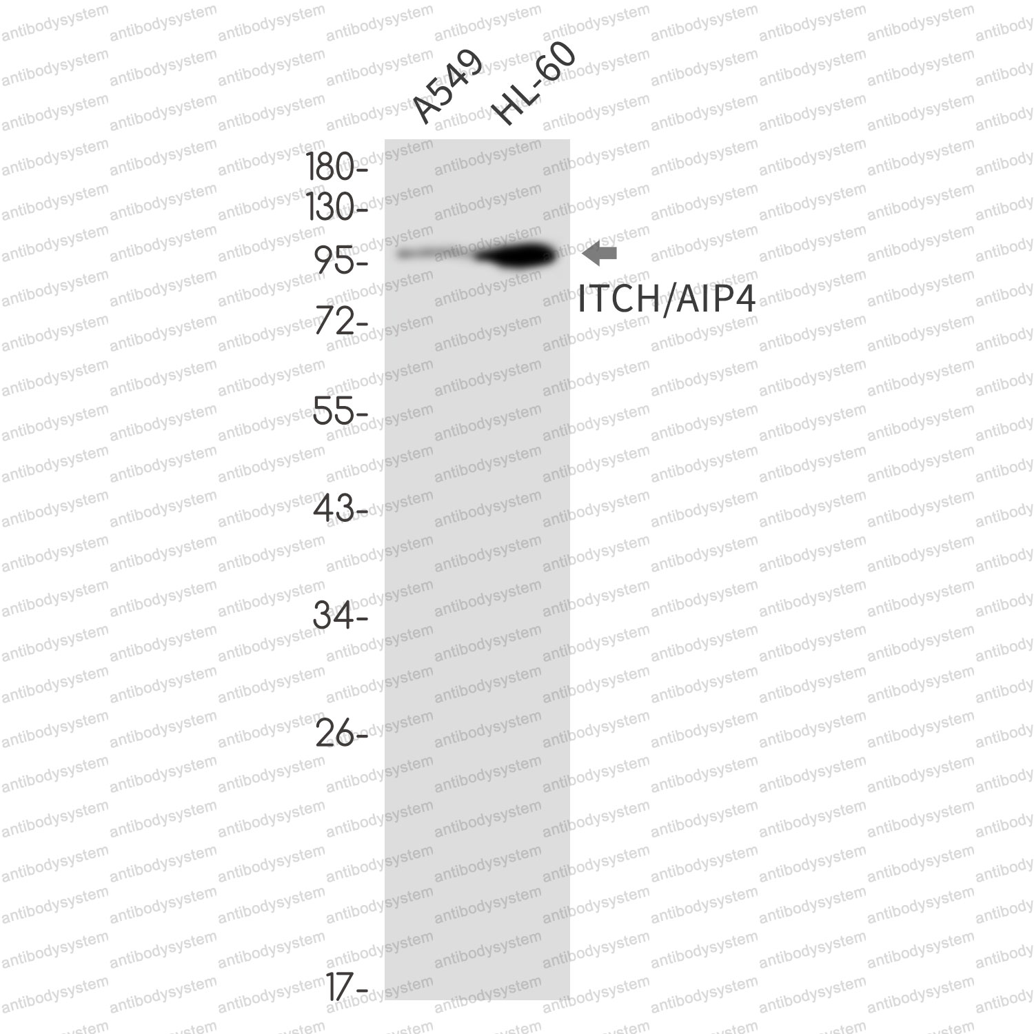 Anti-ITCH Antibody (R2M17)