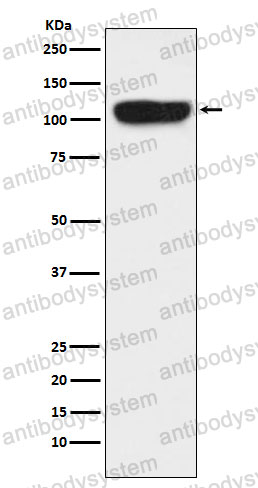 Anti-ITCH Antibody (R2M15)