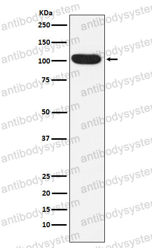 Anti-ITCH Antibody (R2M16)