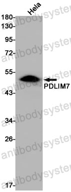 Anti-PDLIM7 Antibody (R2M19)