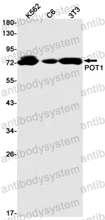 Anti-POT1 Antibody (R2M20)