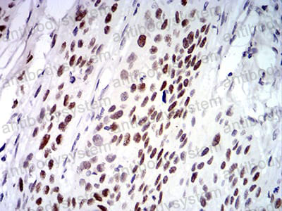 Immunohistochemical for Anti-UFD1 Antibody (R3Z02) ?>