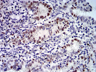Immunohistochemical for Anti-UFD1 Antibody (R3Z02) ?>